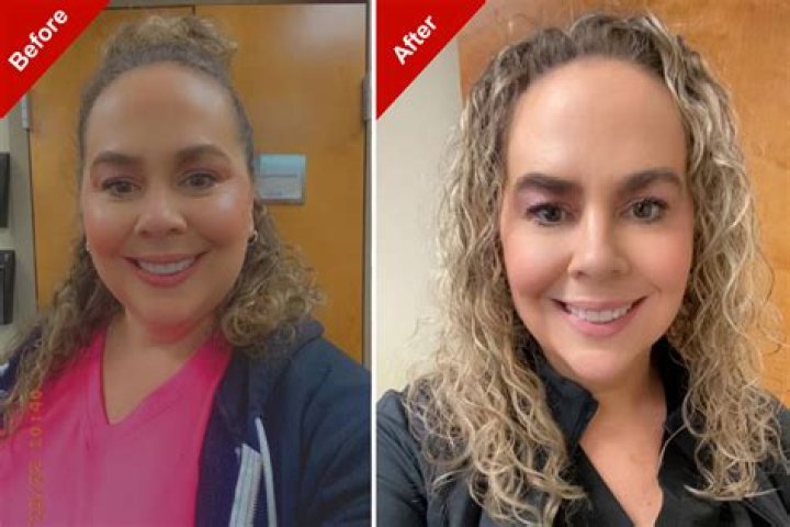 Emma Corrin Weight Loss And Health Update | Before And After Photo